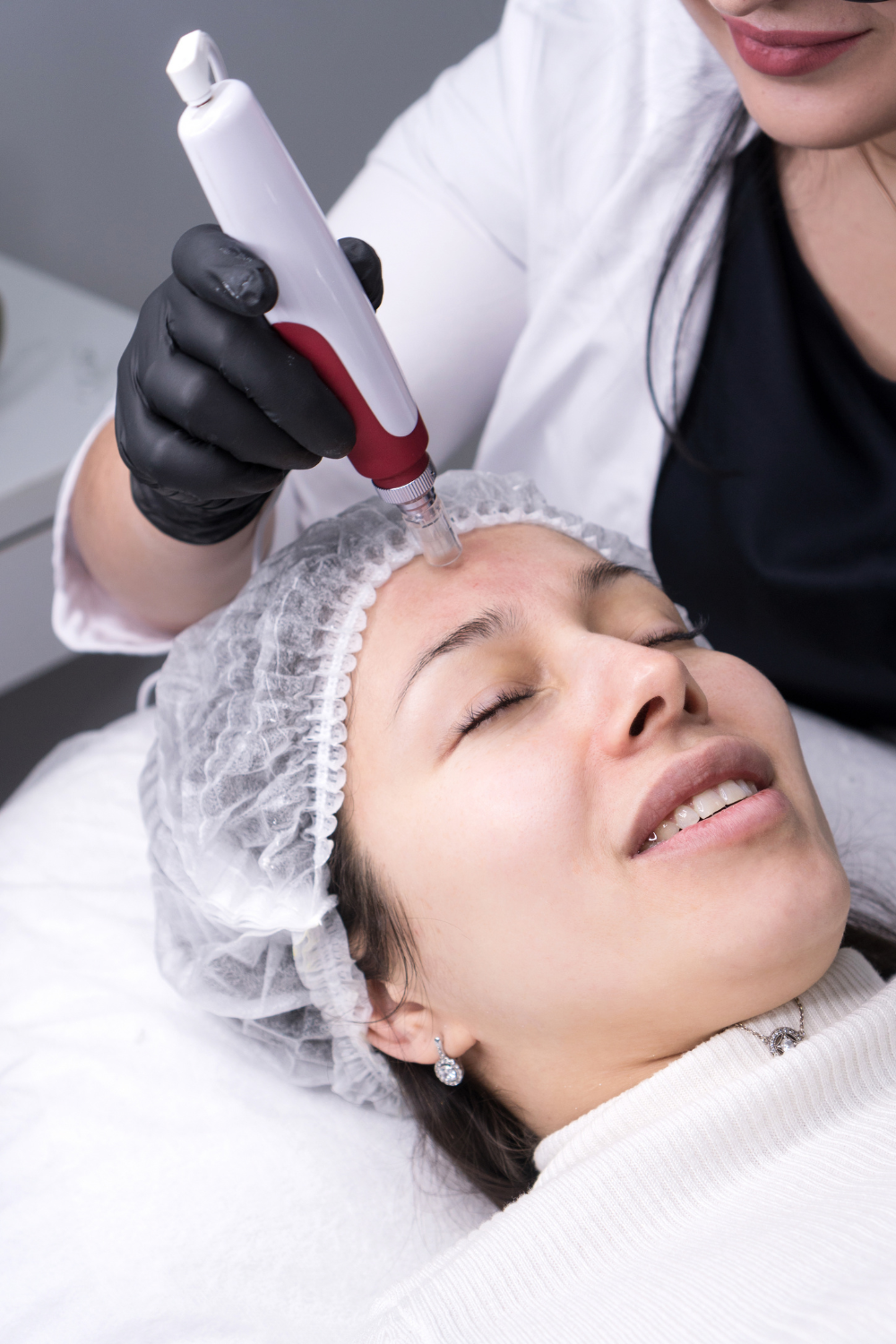 Skin Polishing